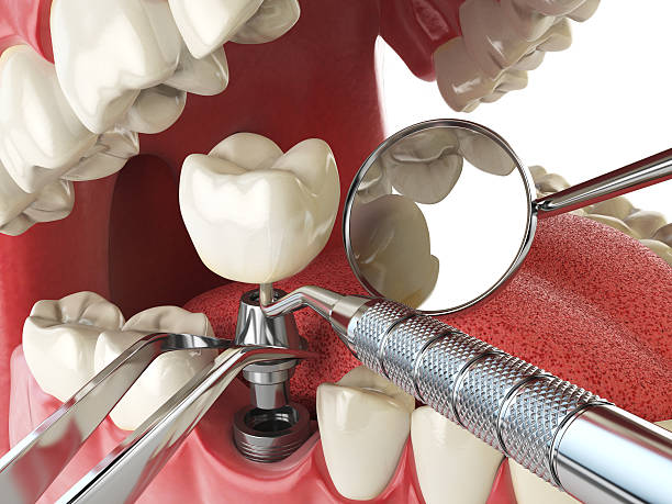 Best Emergency Orthodontic Repairs in Chester, IL